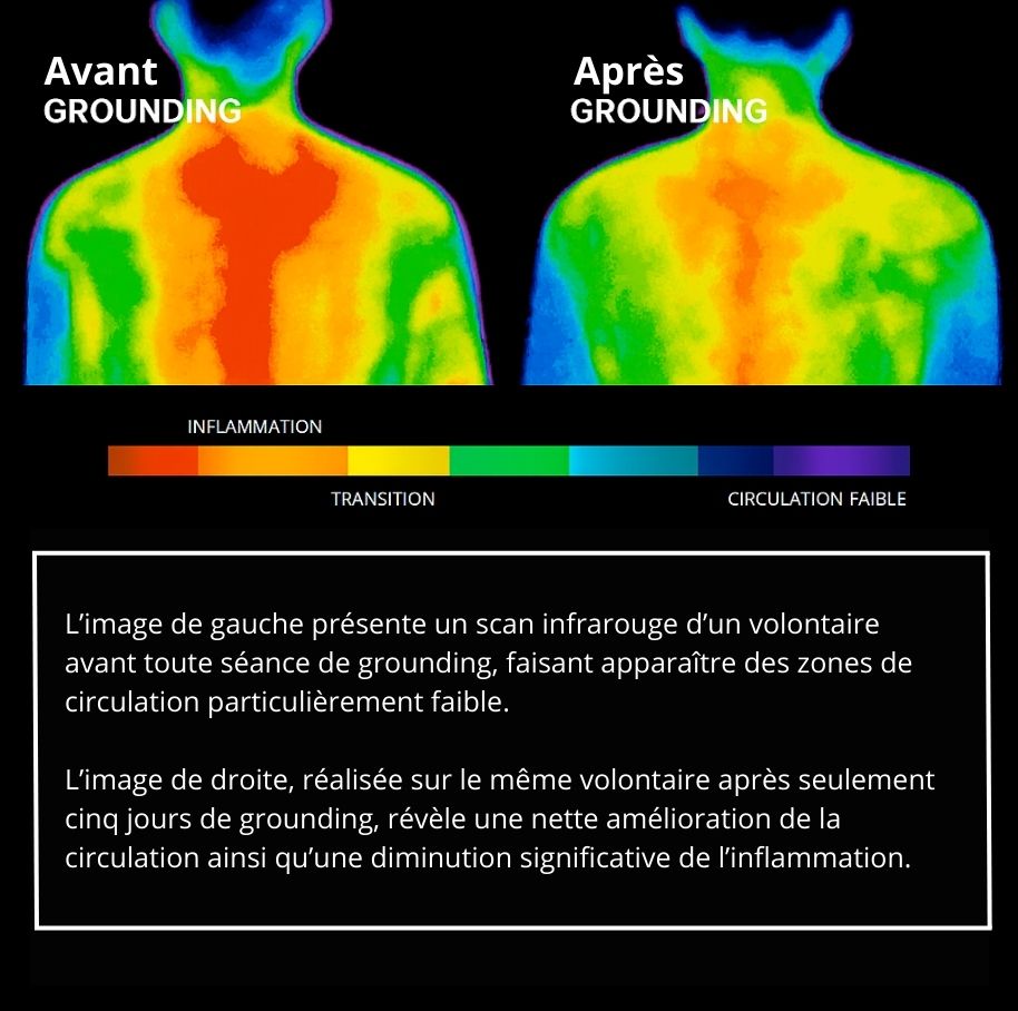Réduction de l'inflammation grounding, earthing
